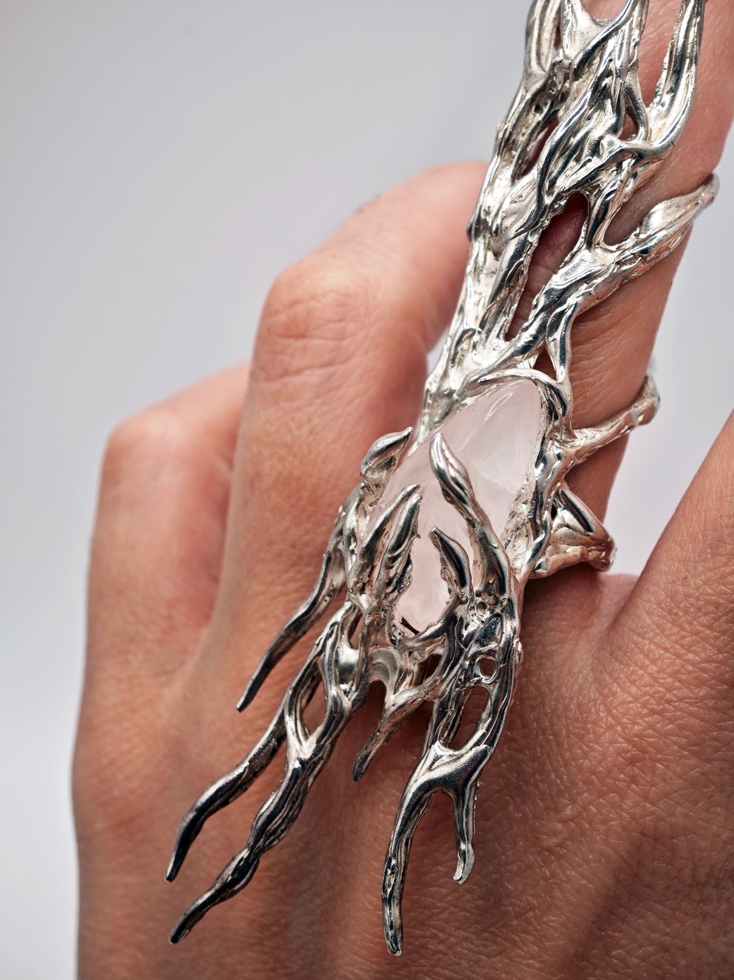 Printzes ring